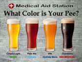 urine test by beer type