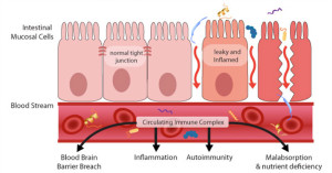 leaky-gut-schematic