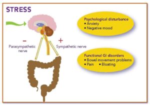 Stress and digestive or GI issues
